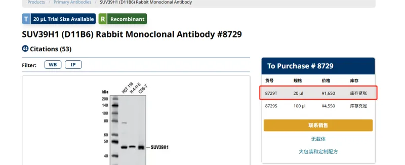 SUV39H1 (D11B6) Rabbit Monoclonal Antibody #8729， 8729T，20µl/支（支） - 玖梧精选