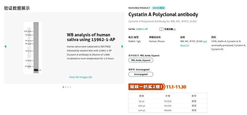 武汉三鹰Cystatin A Polyclonal antibody15962-1-AP-50ul/支 - Proteintech/武汉三鹰