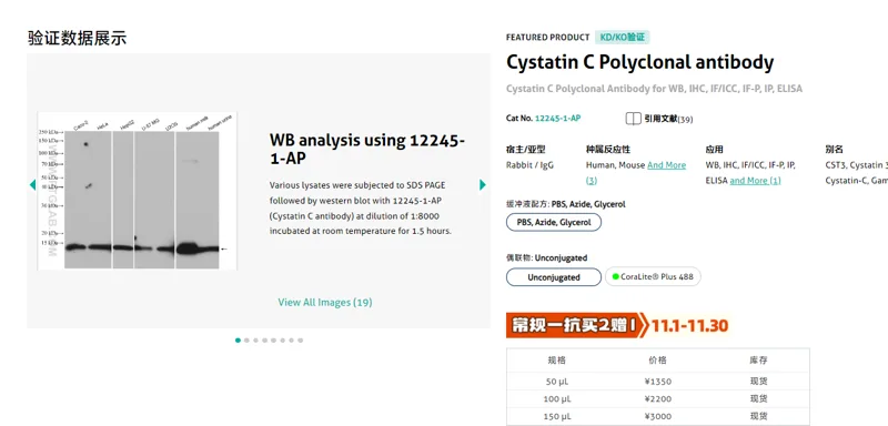武汉三鹰Cystatin C Polyclonal antibody12245-1-AP-50ul/支 - Proteintech/武汉三鹰
