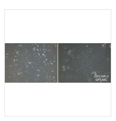 中科院OVCAR-3人卵巢腺癌细胞（支） - 玖梧精选