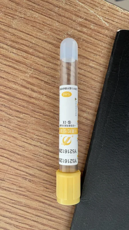 宇力一次性使用真空采血管（支） 5ml黄管（分离胶+促凝剂，100支/盒，1800支/件） - 玖梧精选