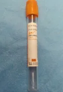 康健SST-10ML采血管（箱） - 江苏康健