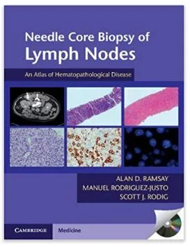 学术书籍（本）Needle Core Biopsy of Lymph Nodes with DVD-ROM: An Atlas of Hematopathological Disease - 玖梧精选