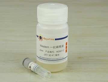Phospho-Estrogen Receptor &alpha;(Ser118)抗体(兔单抗) - Beyotime/碧云天