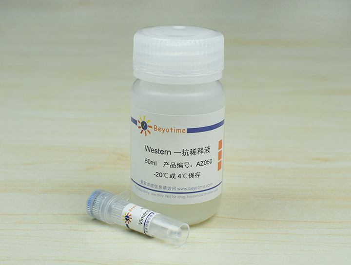 Vimentin Mouse Monoclonal Antibody抗体