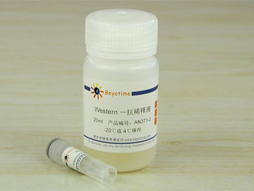 Phospho-NF-&kappa;B p65(Ser536)抗体(兔单抗) - Beyotime/碧云天