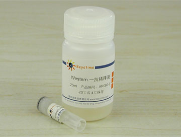 Phospho-Rb(Ser807/811)抗体(兔多抗) - Beyotime/碧云天