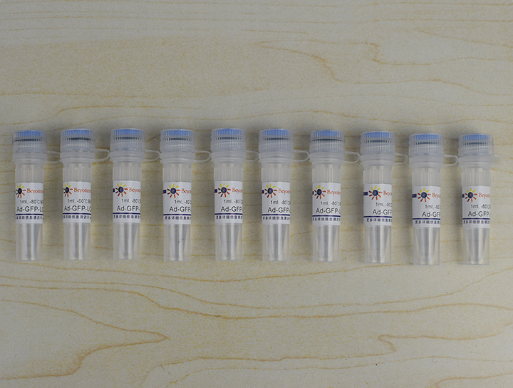 Ad-GFP-LC3B - Beyotime/碧云天