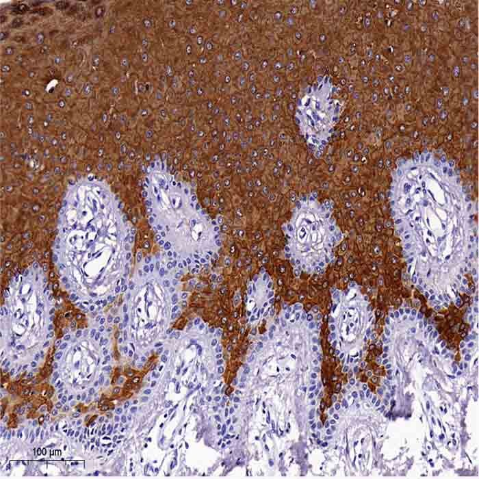 HRP-Polymer抗鼠/兔通用型IHC试剂盒 - AiFang biological/艾方